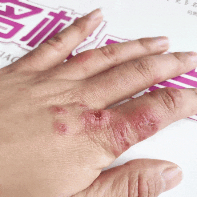 不朽情缘官网登录手足干裂的人试试这个外抹的方子一试就灵(图8)