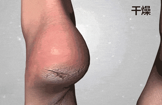 不朽情缘官网登录手足干裂的人试试这个外抹的方子一试就灵(图6)